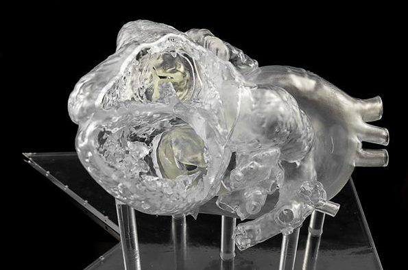 3D打印心臟有助開發(fā)救生導(dǎo)管